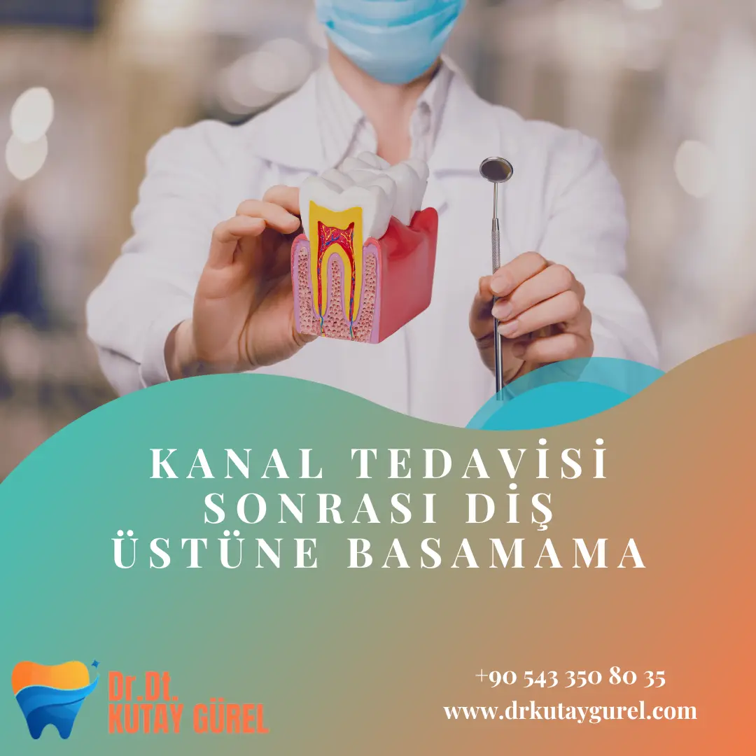 kanal tedavisi sonrası diş üstüne basamama