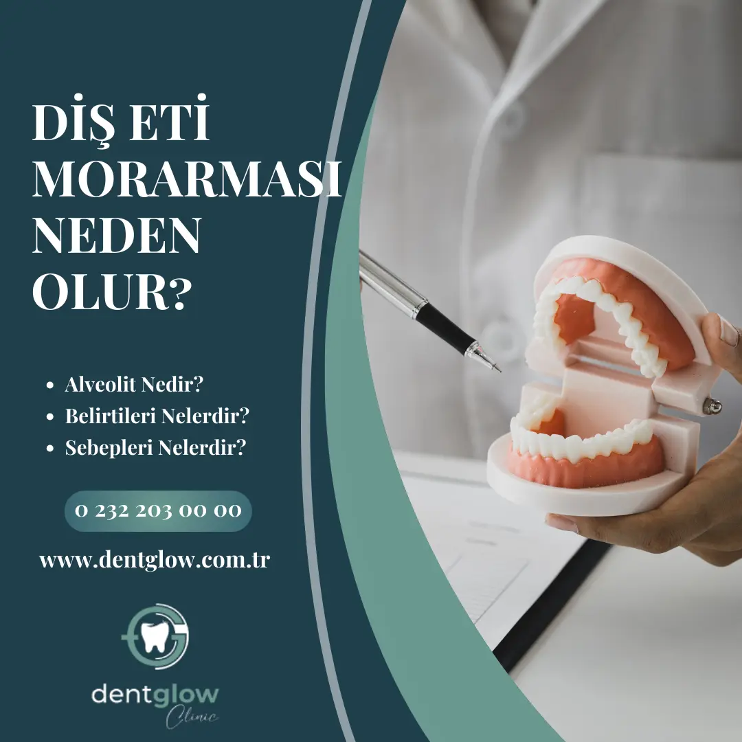 Boğaz ağrısı varken diş çekilir mi