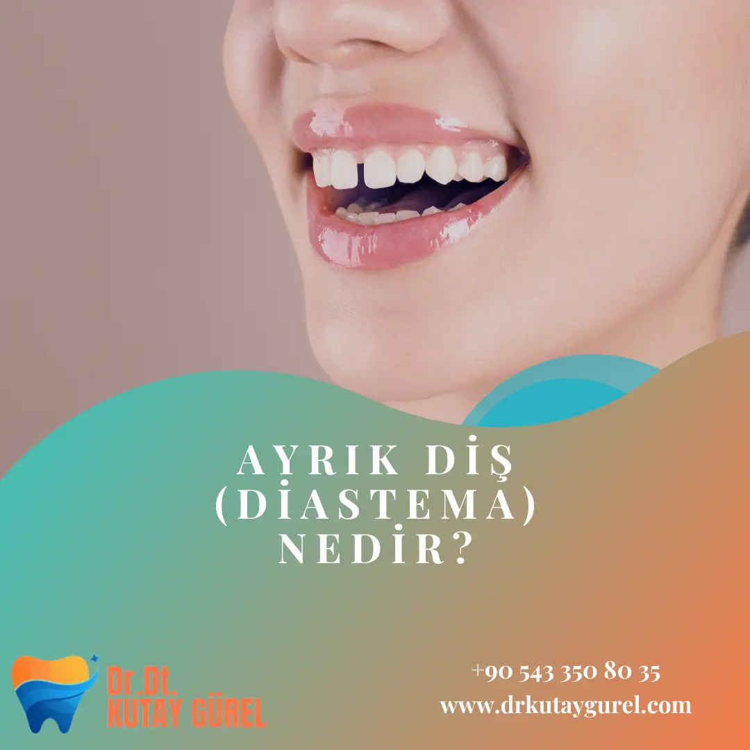 Eski dolgulu Dişim Ağrıyor ne yapmalıyım