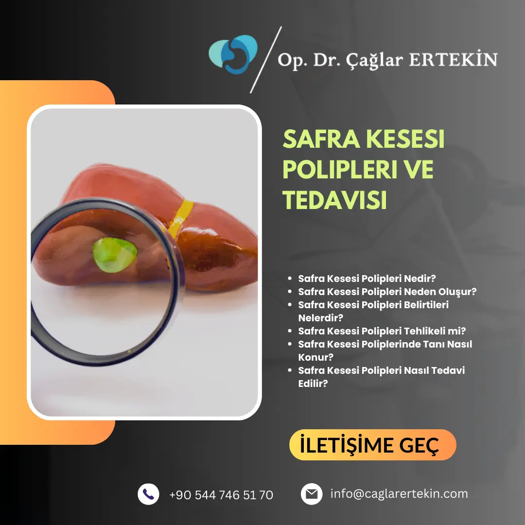kapalı safra kesesi ameliyatı sonrası nelere dikkat edilmeli