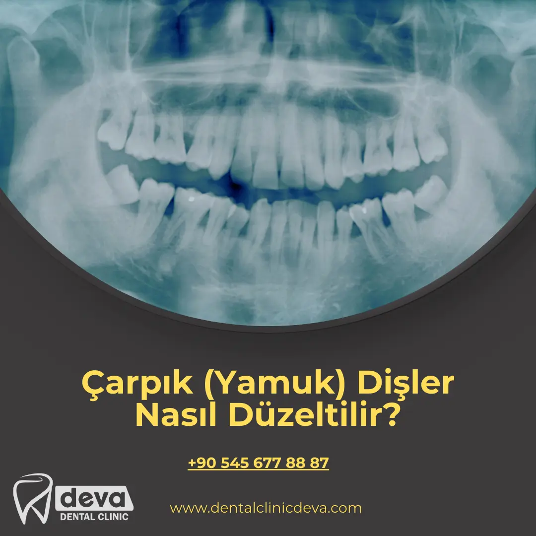 alveolit görüntüsü