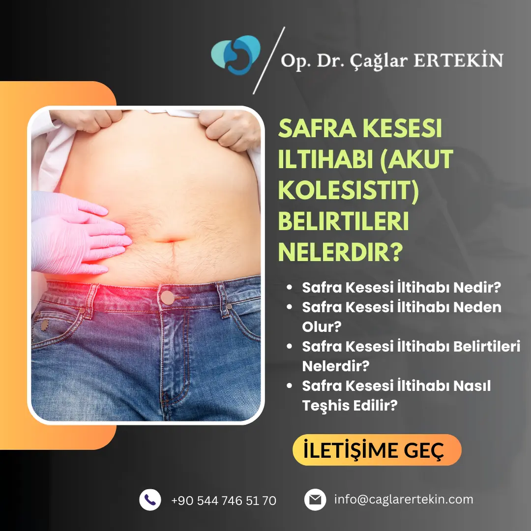 Safra kesesi ameliyatı sonrası kaçak