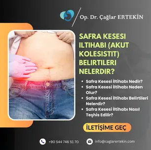Safra Kesesi İltihabı (Akut Kolesistit) Belirtileri Nelerdir?