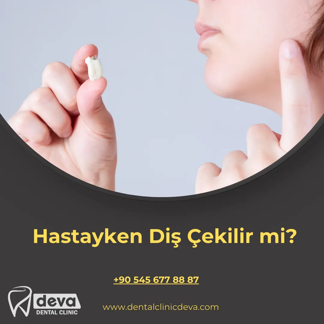 Geçmeyen alveolit