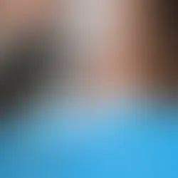 botoks sonrası baş ağrısı için ne iyi gelir