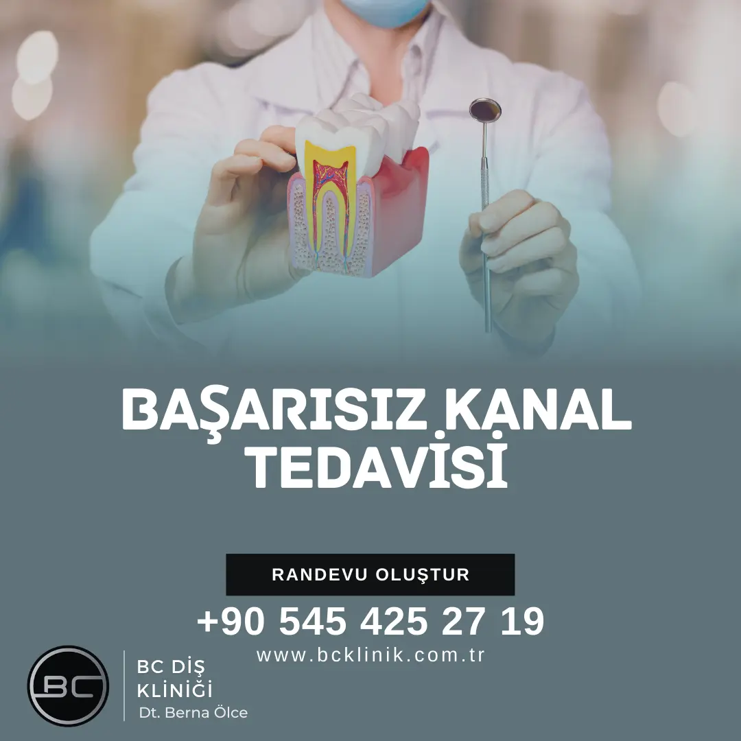 kanal tedavisi yaptırdım ama dişim ağrıyor