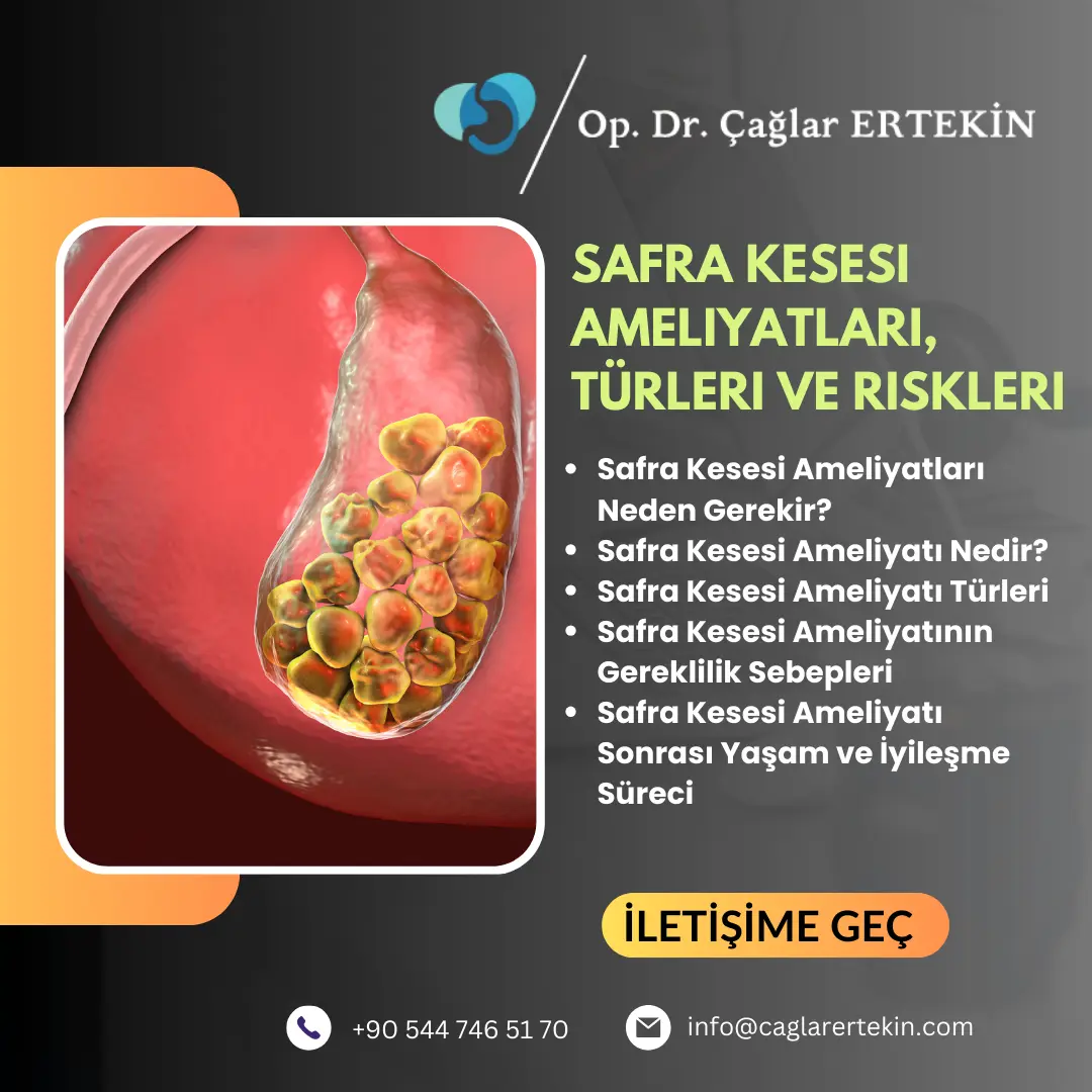 Safra kesesi ameliyatı sonrası enfeksiyon belirtileri