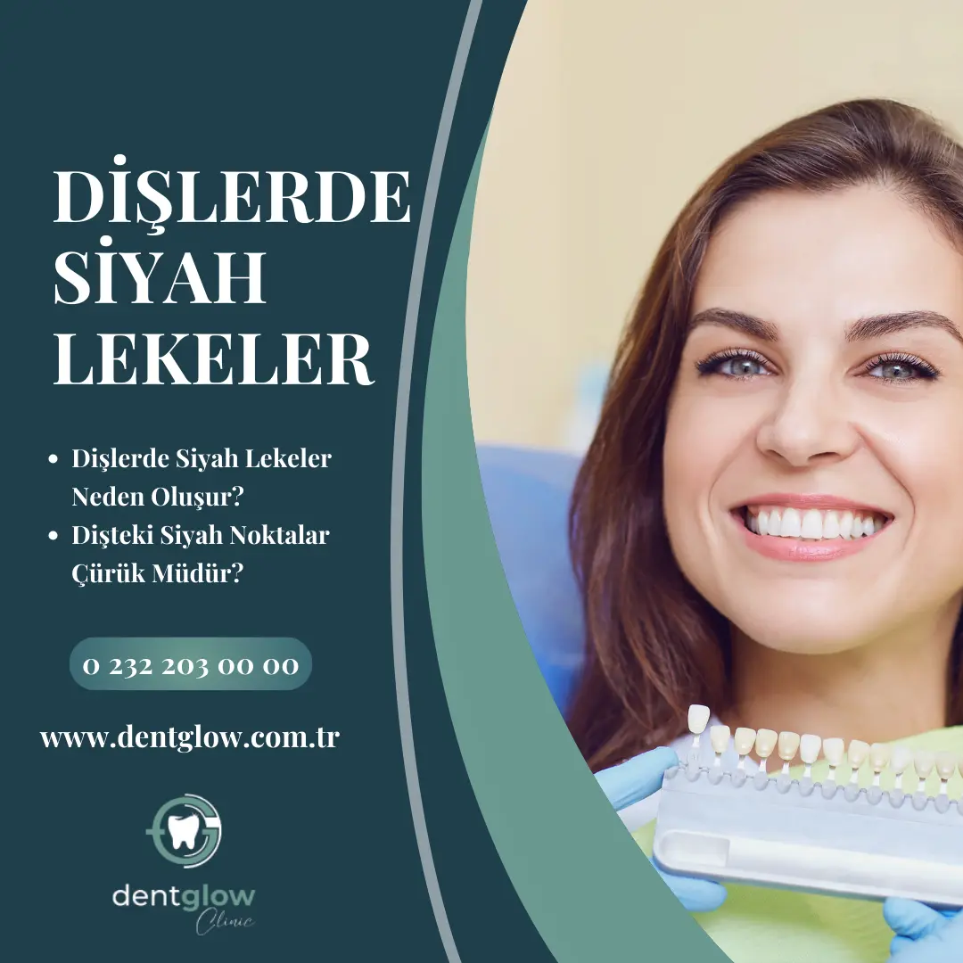 Genç Yaşta İmplant Yapılır mı? genç yaşta implant yaptiranlar kadınlar kulübü