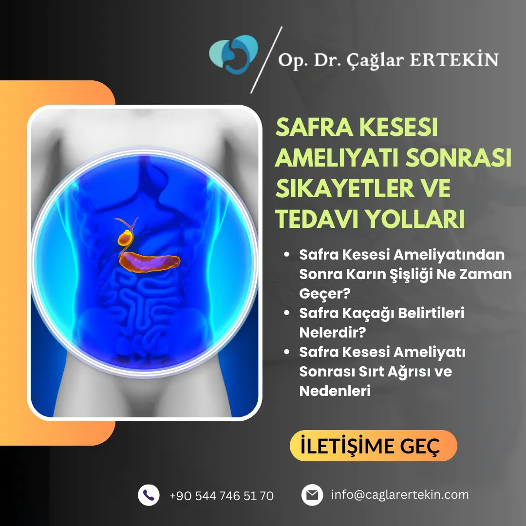 Safra kesesi ameliyatı sonrası safra kaçağı Belirtileri Kadınlar Kulübü