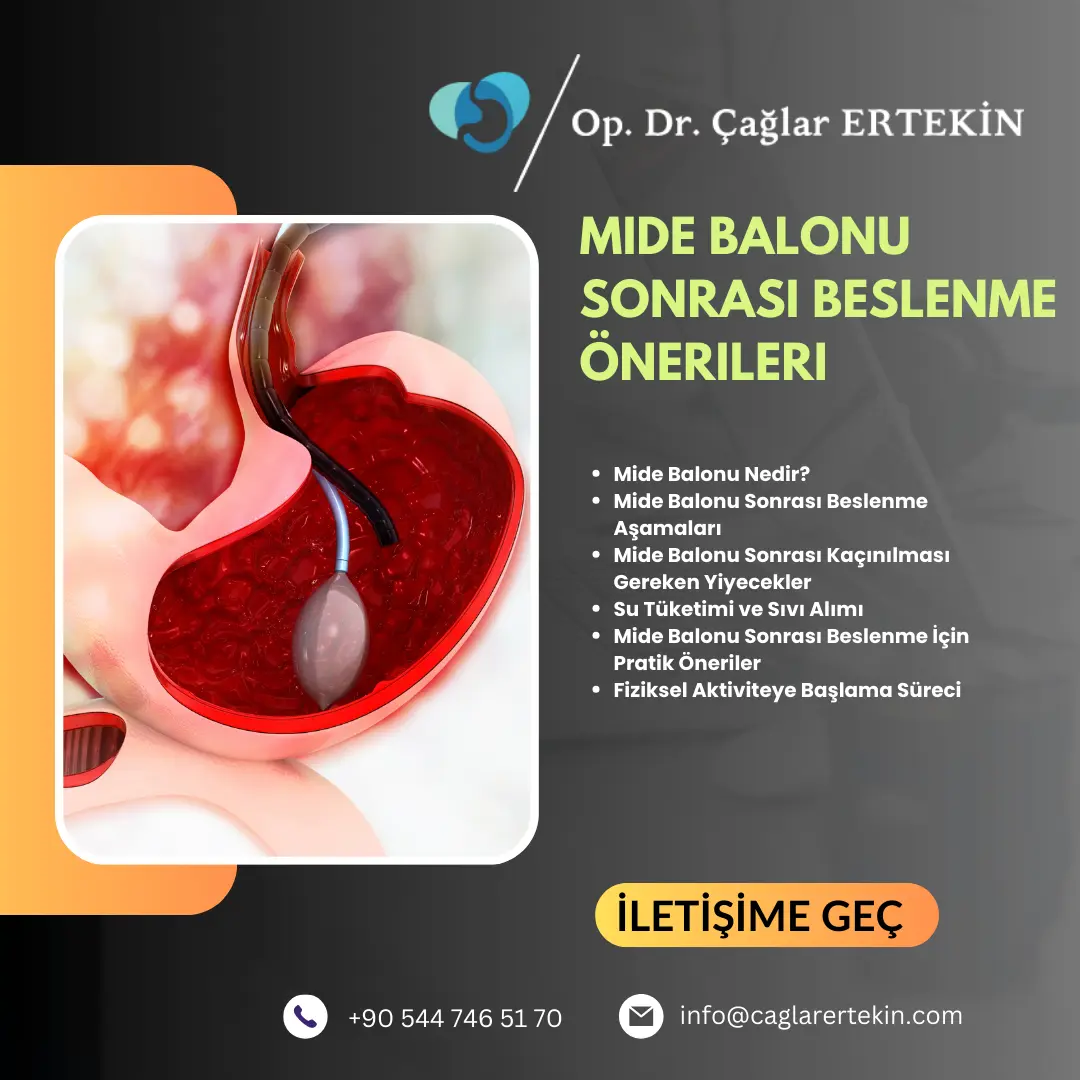 Endoskopik mide balonu