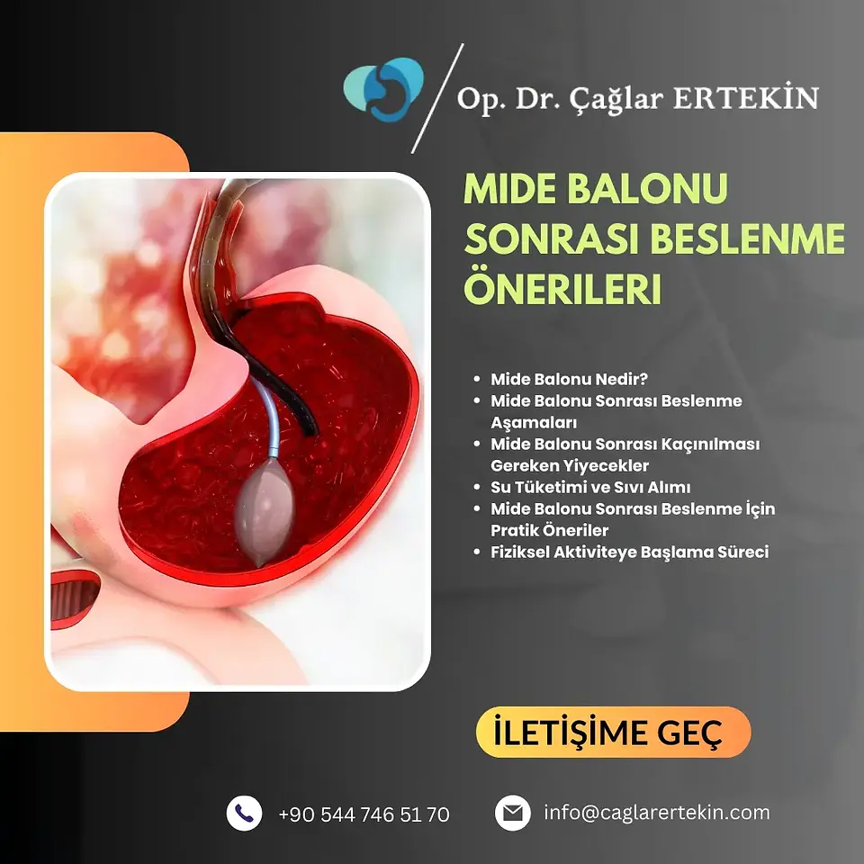Endoskopik mide balonu