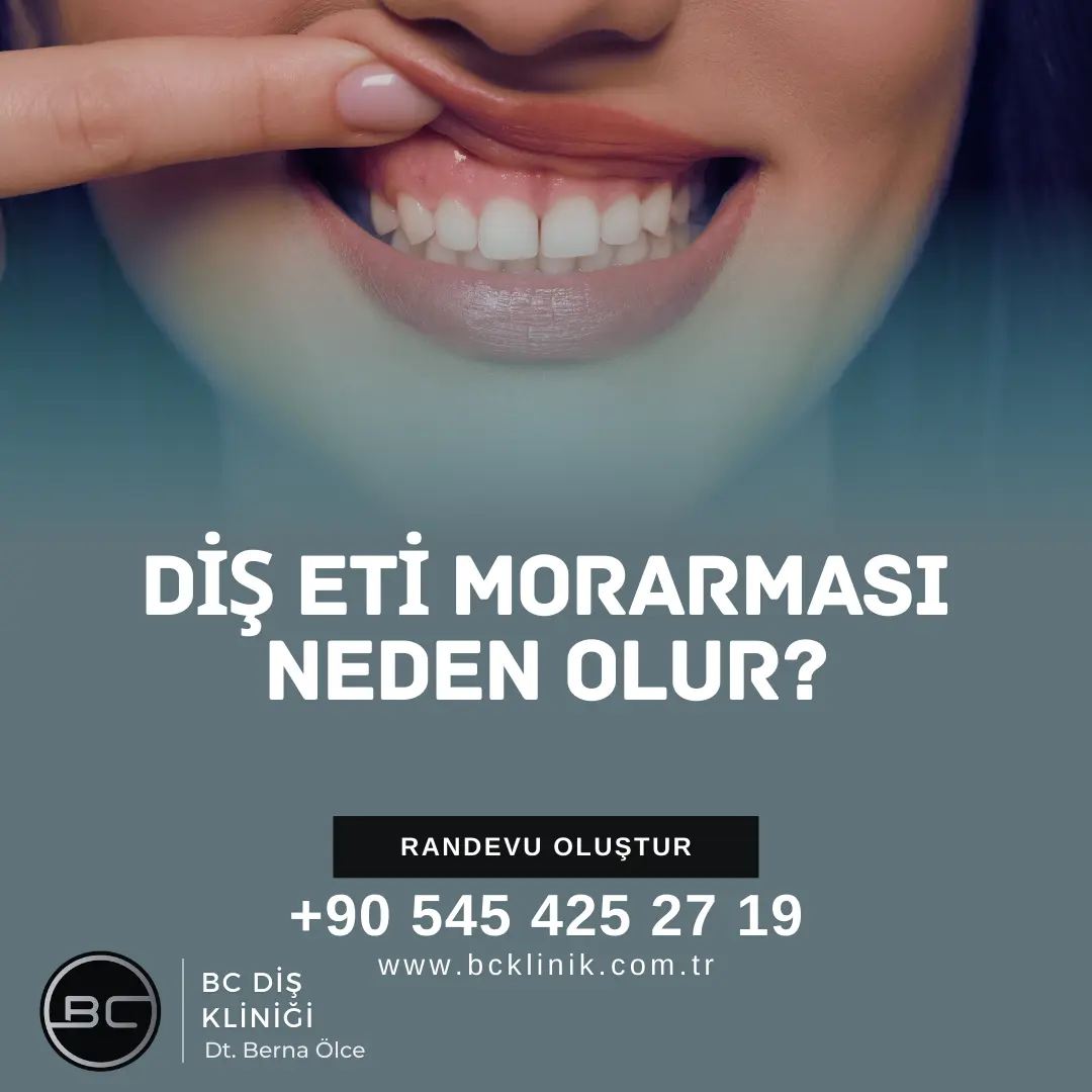 Yetişkinlerde diş kaşıntısı neden Olur