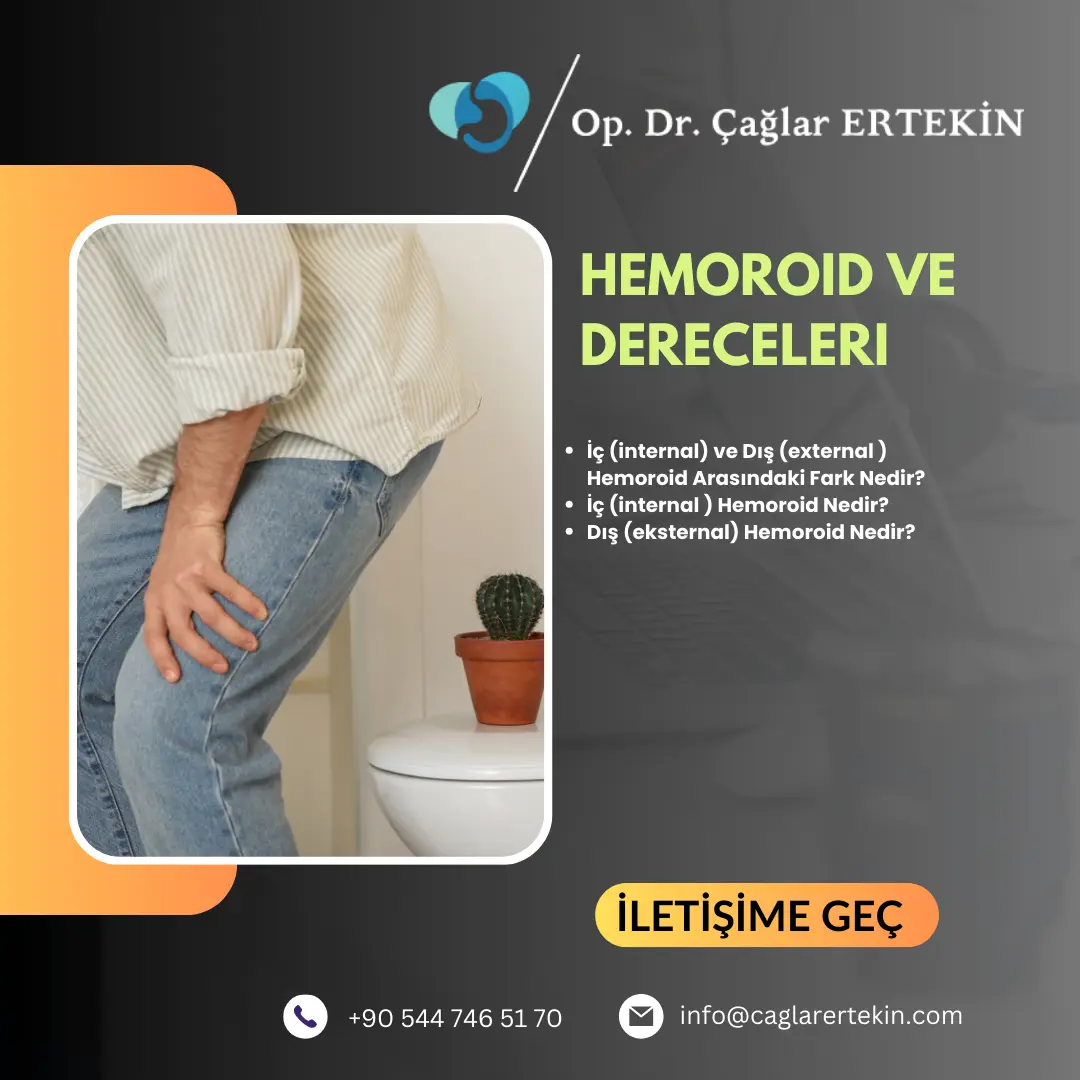 makat kenarında şişlik nasıl geçer