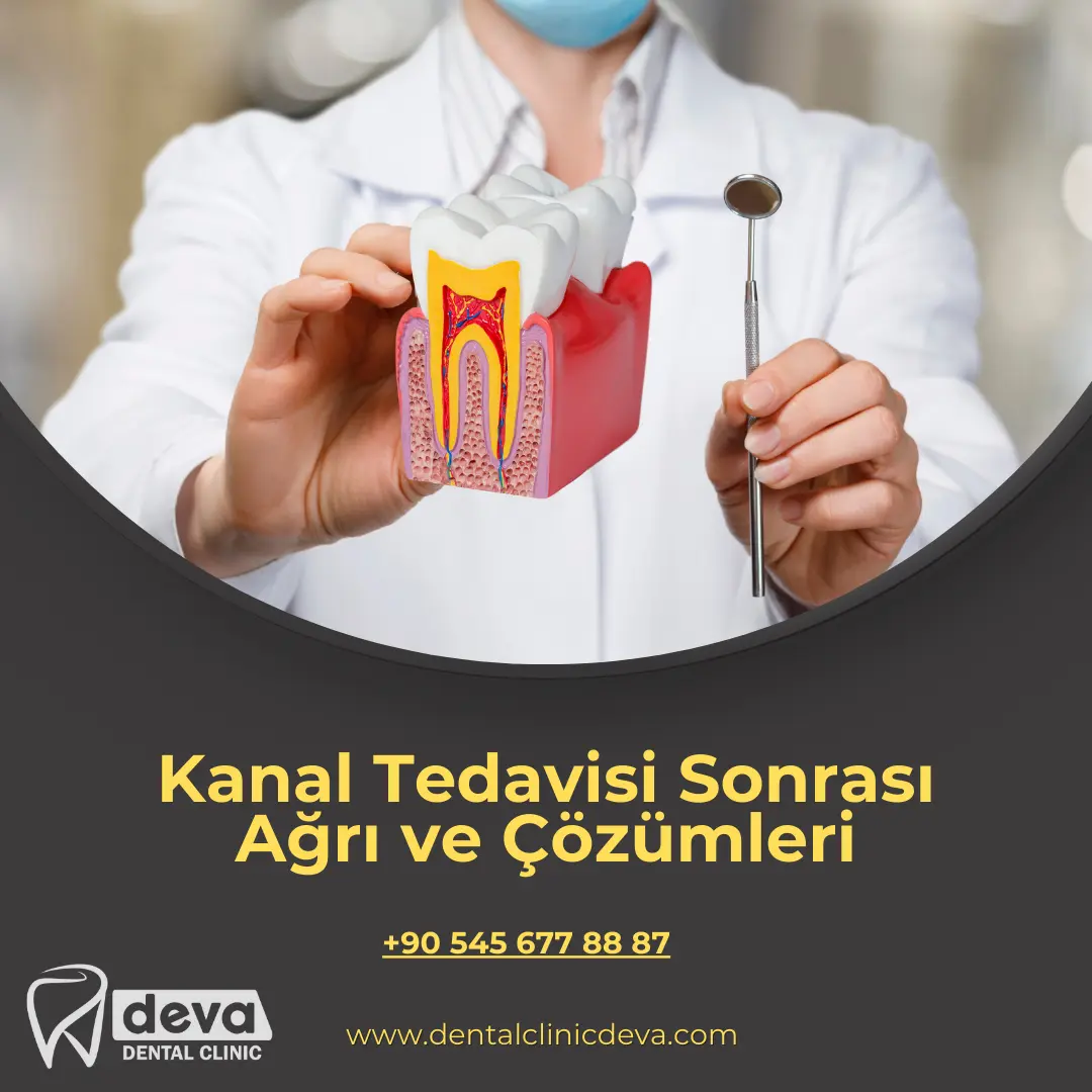 implant tedavisi ne kadar sürer