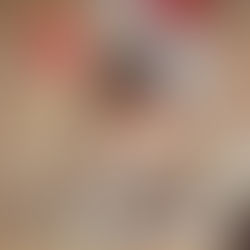 How Can You Tell if Anxiety is Holding You Back at Work?