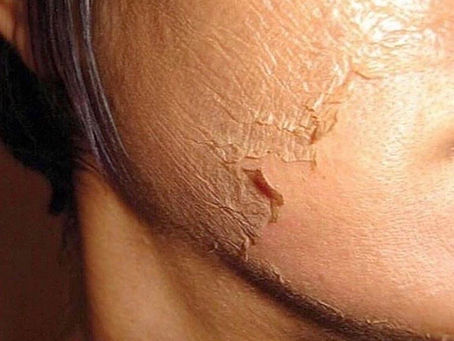Unveiling Radiant Confidence: Skin Treatments at The KS Clinic