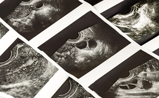 Whether it's IVF or planning to try naturally, ovulation tracking can take out e guess work