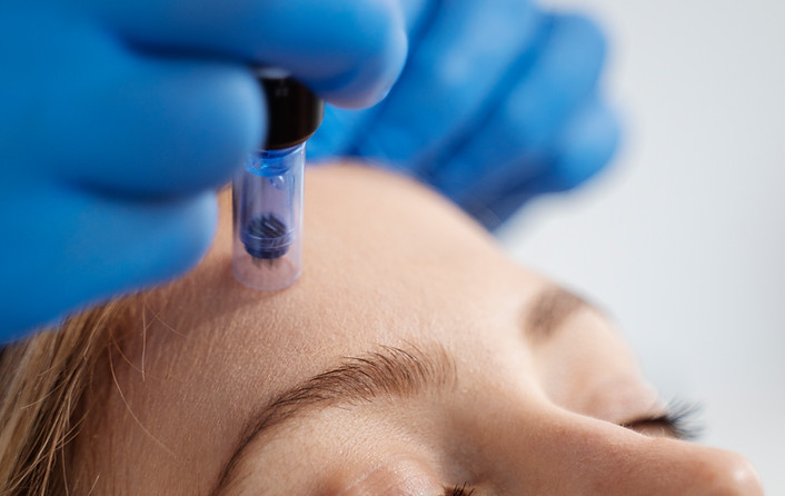 Client receiving microneedling treatment at Skin and Slim Abu Dhabi
