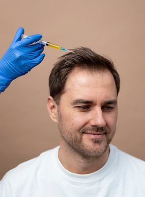 Before-and-after-prp-hair-therapy-treatment-abu-dhabi.jpg