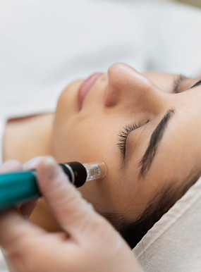 Close-up of microneedling device on a client’s facial skin
