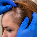 Hair restoration for thinning temples in Abu Dhabi
