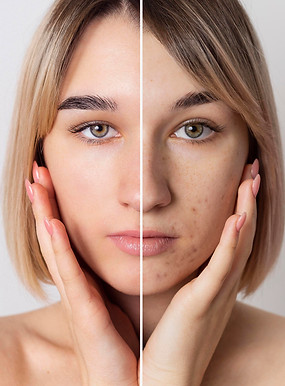Before and after pigmentation removal results at Skin and Slim Abu Dhabi showing clearer, more even skin