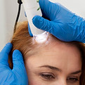 Hair loss treatment for overall scalp thinning in Abu Dhabi