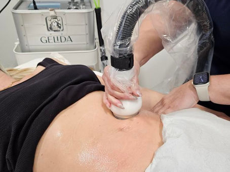 Everything you need to know about Cryo21