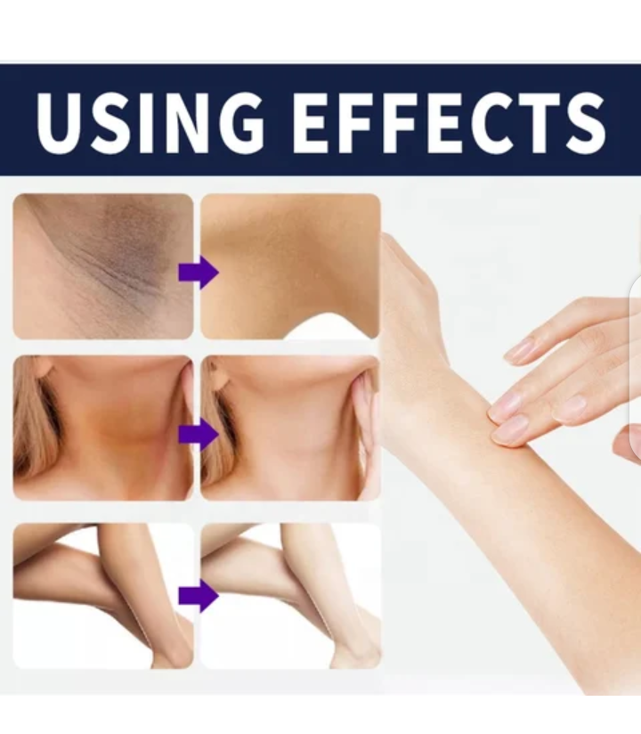 Thumbnail: DETVFO Sensitive Area whitening Cream