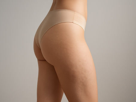 Cellulite bei Schlanken – was kann man dagegen tun?
