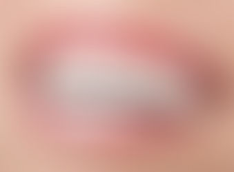 Ano Novo, Sorriso Novo