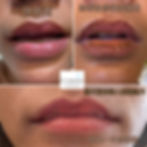 霧唇後唇反黑顏色不均而來除霧唇