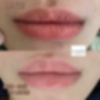 霧唇除淡一次後