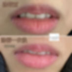 改善唇部黑色素