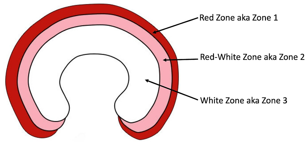 ree