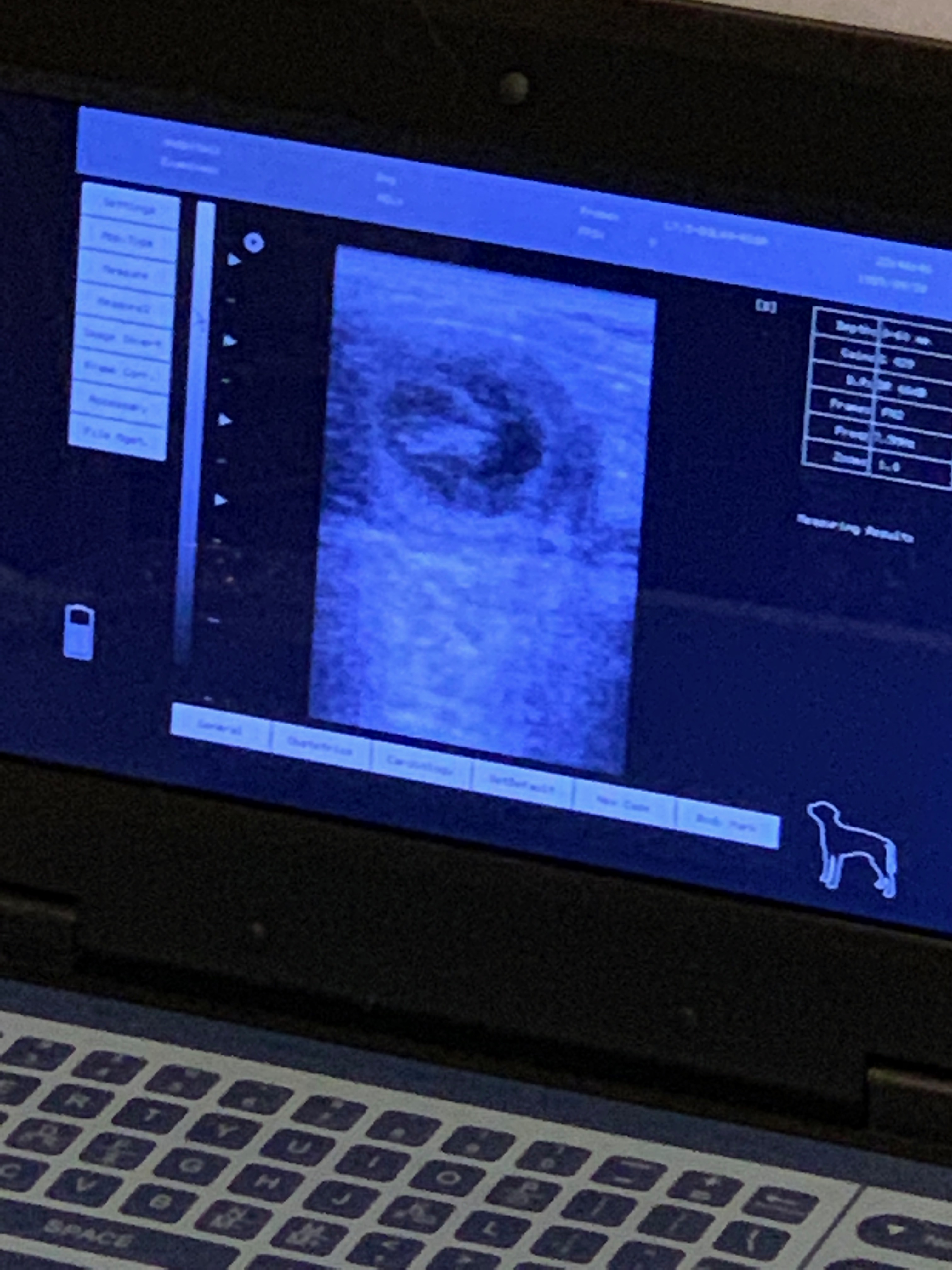 Ultrasound showing a baby