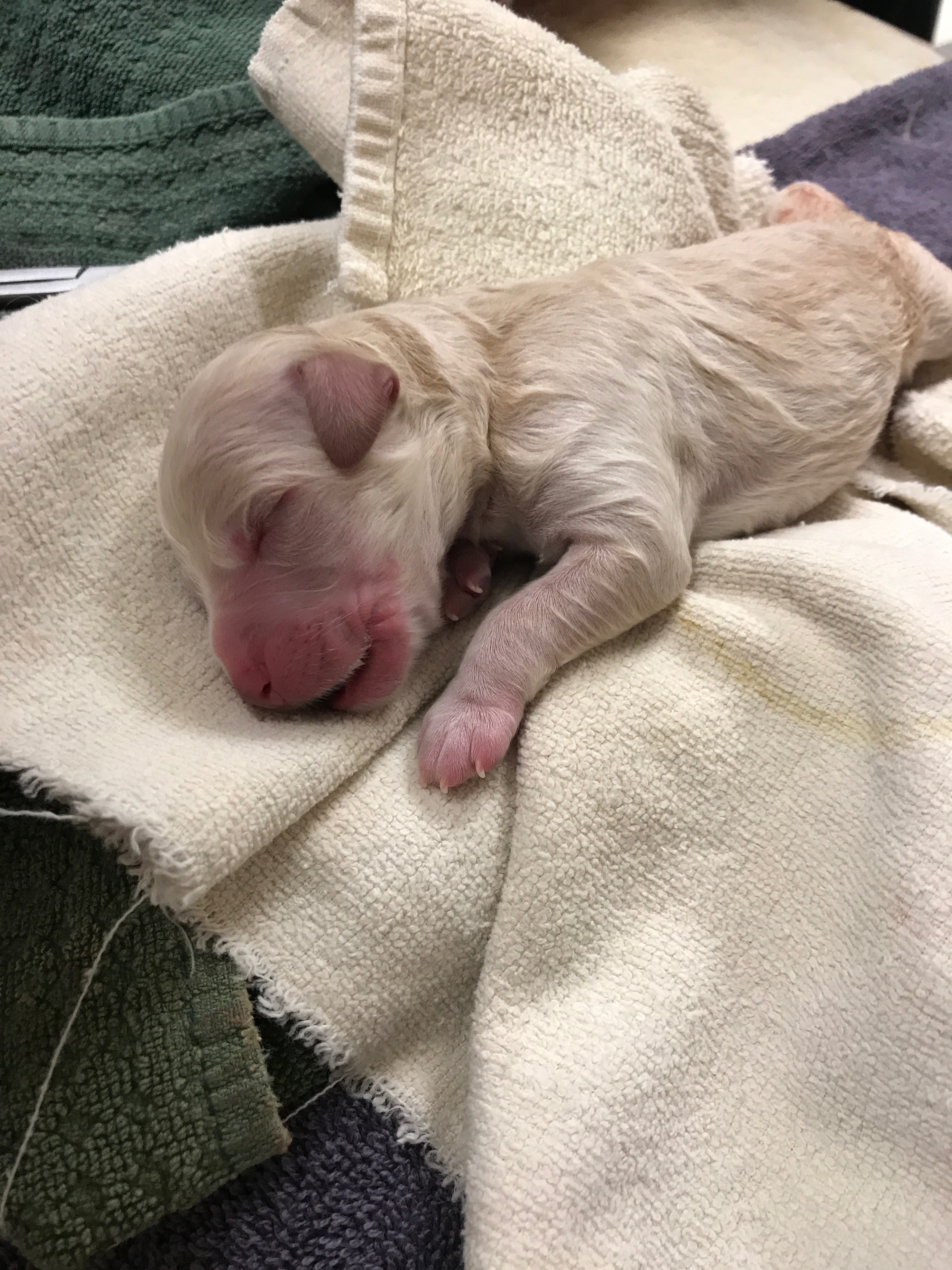 C-section