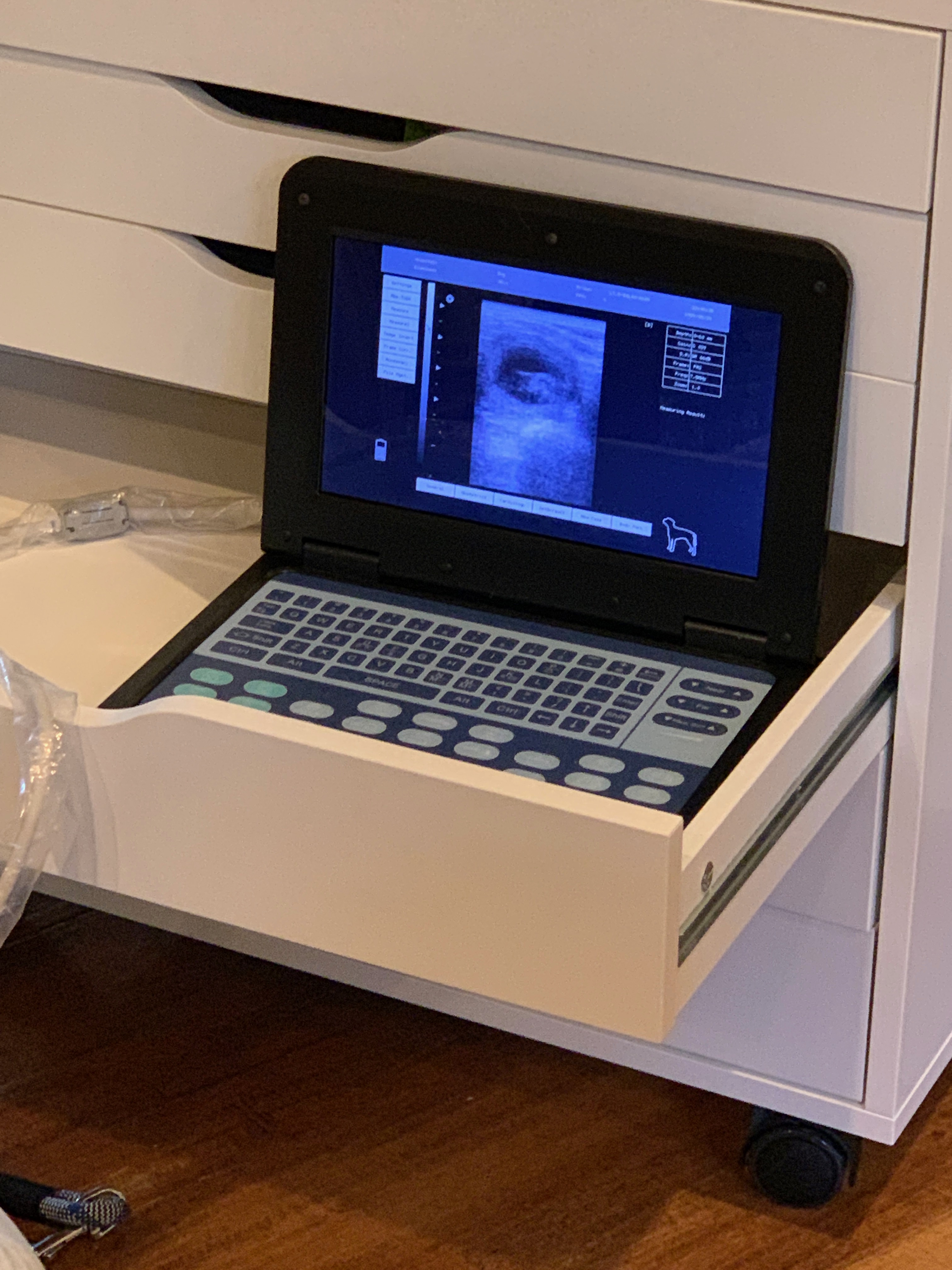 Ultrasound Photo