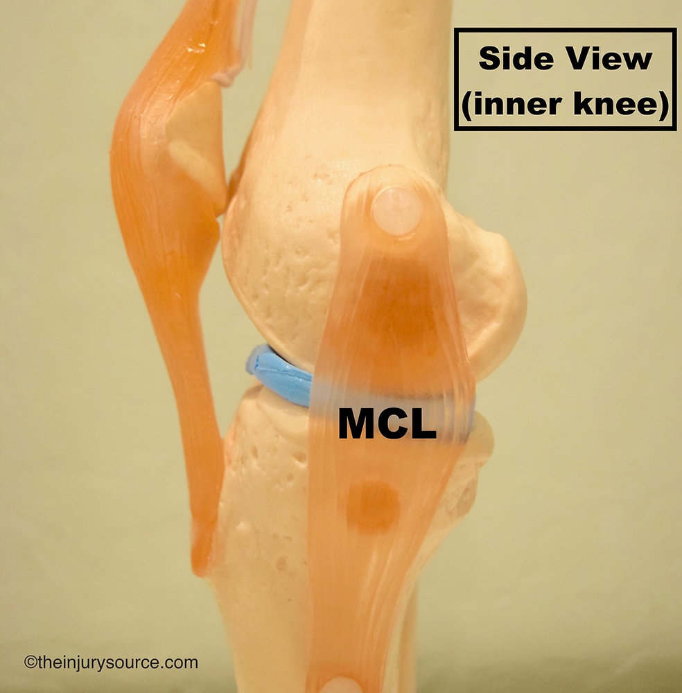 Isolated MCL (Medial Collateral Ligament) Injury