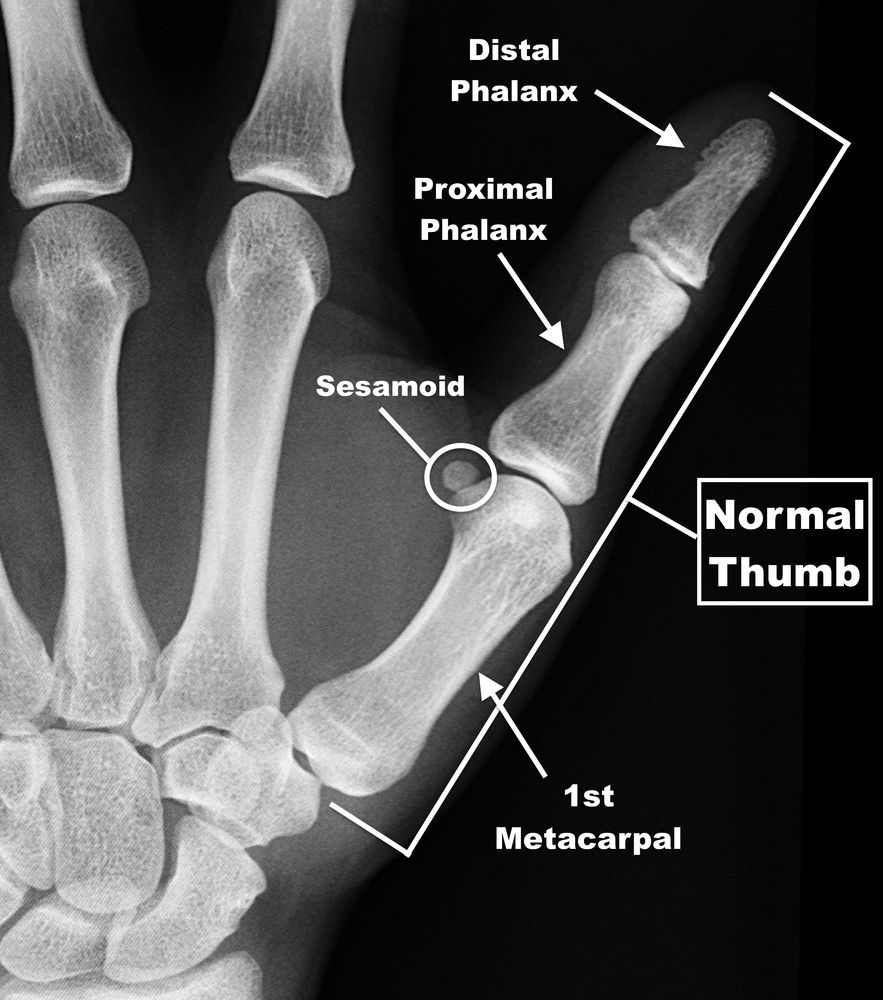 All Thumbs In NFL Camp Week 1 all-thumbs-in-nfl-camp-week-1