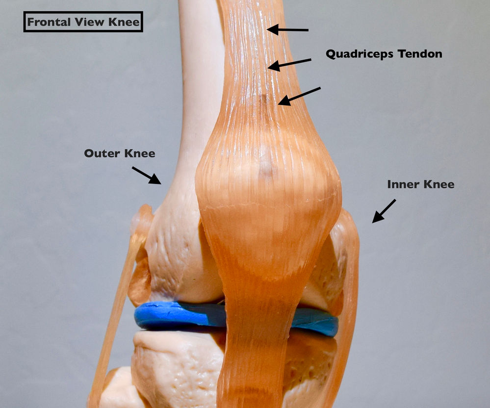 Quadriceps Tendon Rupture