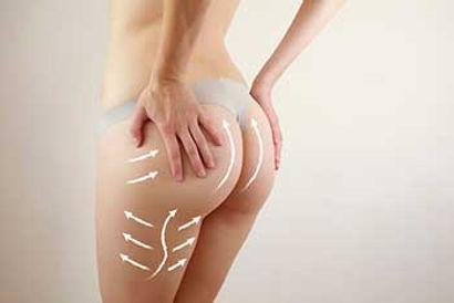 emsculpt-willowbrook-il.jpg