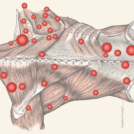 Trigger Points: The Key to Muscle Relief