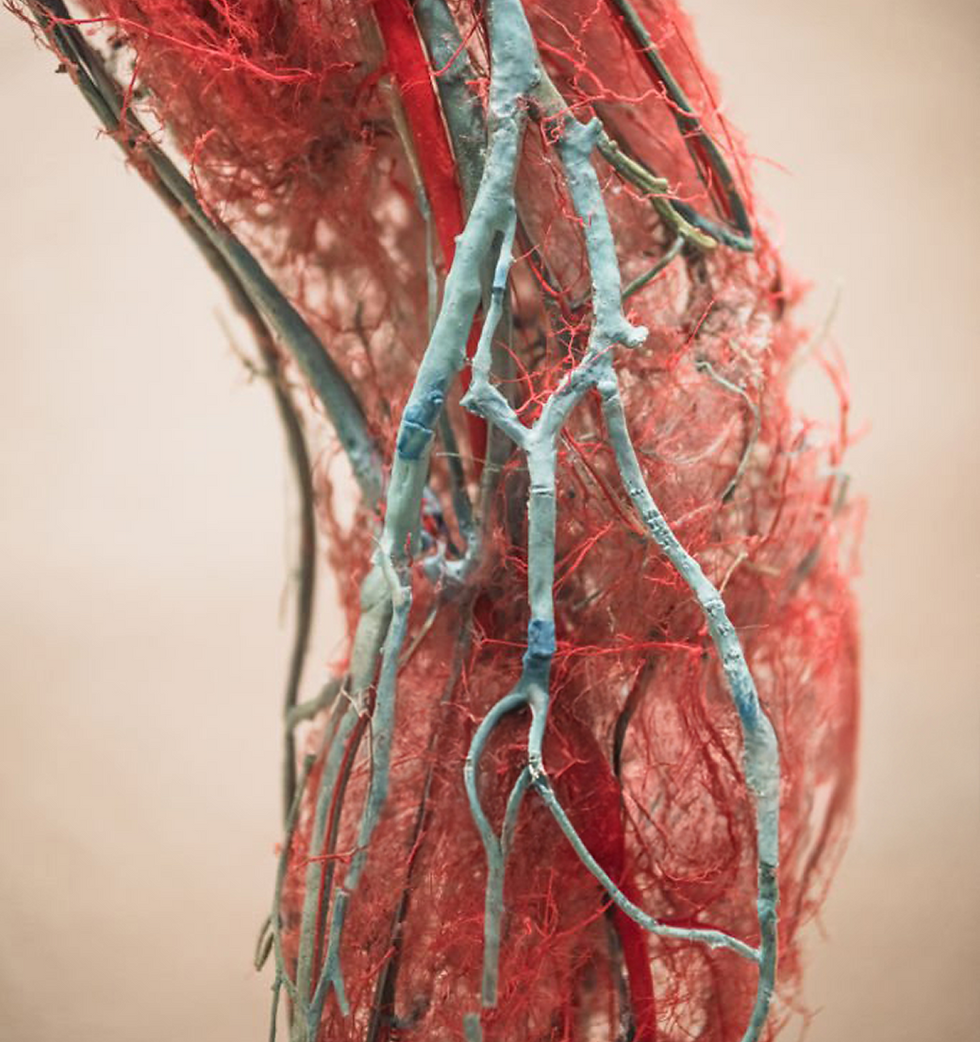 Vascular structure of knee and surrounding limb with calcified vessels