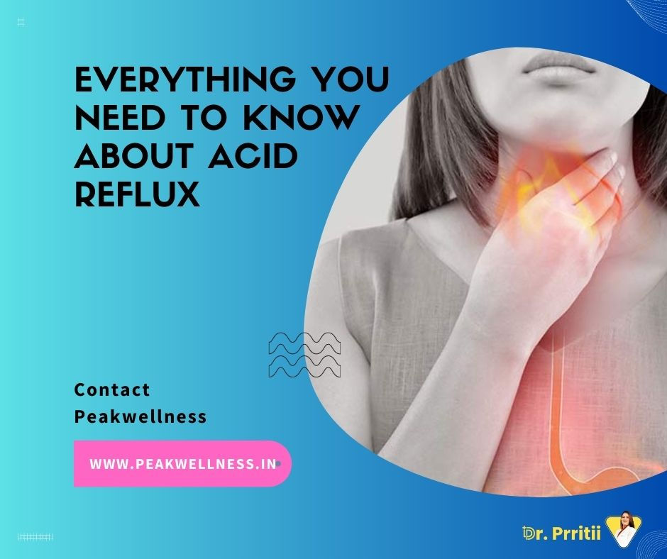 Acid Reflux