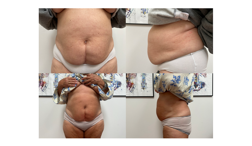 Miniaturebillede: Body Shaping