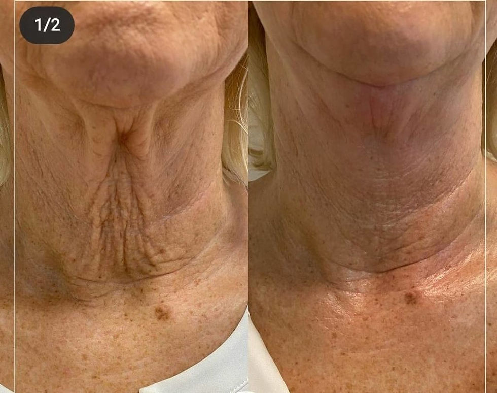 Miniaturebillede: Ultra Fat-Knife Behandlinger