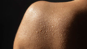 My Skin Is Always Dry No Matter What — Could It Be the Water?
