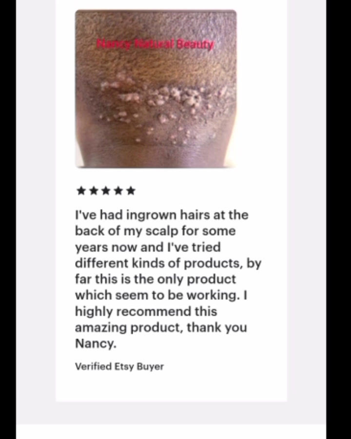 Razor Bump Stopper Cream