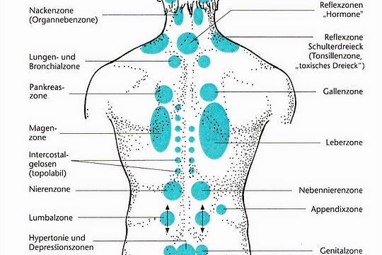 Reflexzonen am Rücken zur Neuraltherapie, Injektionsorte nach Head